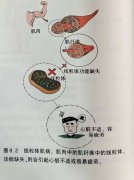 氫氣針對(duì)治療肌肉的臨床研究
