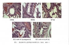 氫氣治療幼年大鼠支氣管哮喘機(jī)制研究
