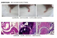 氫氣在治療類風濕關節(jié)炎中的作用及機制研究
