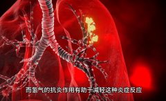 氫分子改善痛風癥狀
