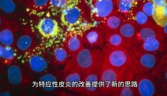氫分子改善特應性皮炎