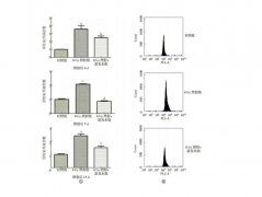 TLR4/NF-κB信號(hào)通路在富氫水改善電離輻射致大鼠放射性腦損傷中的作用