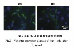 氫分子對肝癌細(xì)胞Huh7的影響