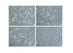 氫氣對HaCaT角質(zhì)形成細(xì)胞增殖及炎癥因子表達(dá)的影響