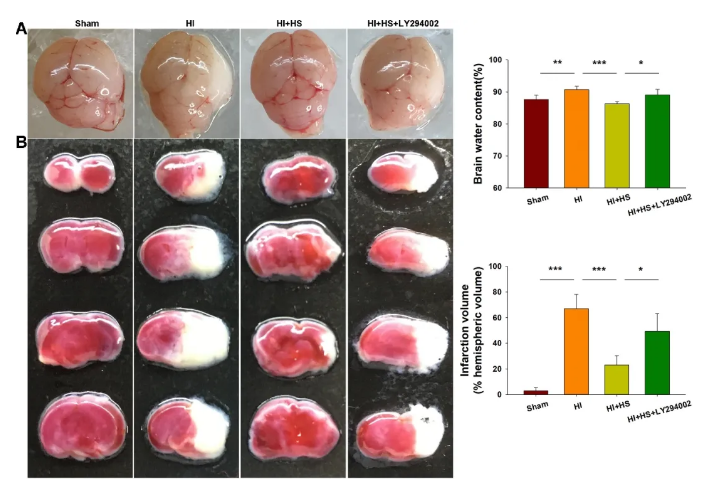 氫氣改善新生兒腦缺血機(jī)制研究【山大】