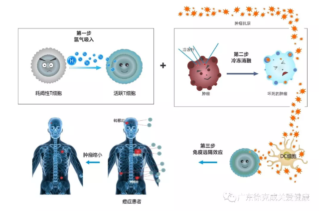 控癌新思路：冷凍消融+吸氫