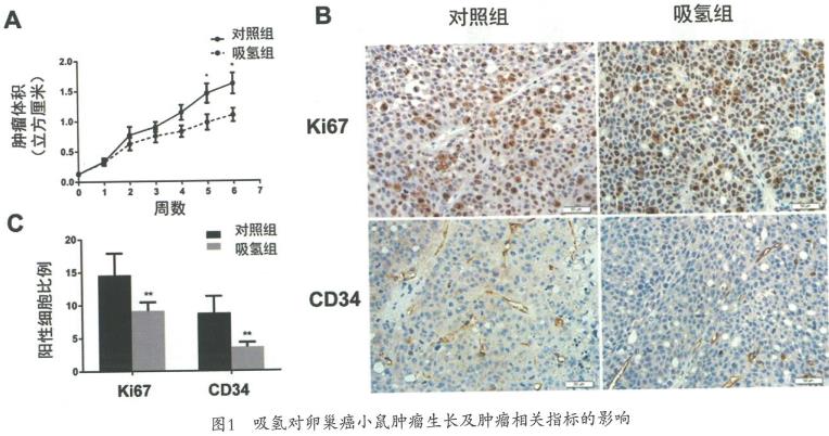 氫氣抑制卵巢癌的實(shí)驗(yàn)研究，氫氣能抑制腫瘤細(xì)胞的侵襲和遷移