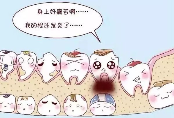 富氫水對牙齦氧化應(yīng)激和牙槽骨吸收的預(yù)防作用