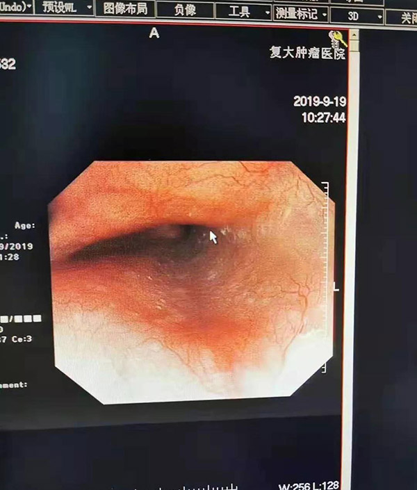 她的腫瘤神奇消失，誰的功勞？