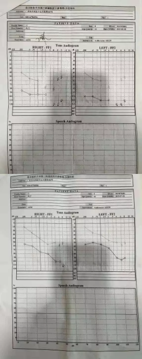 治療副作用讓她幾度輕生，吸氫讓她煥發(fā)新生