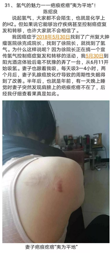 肝細(xì)胞及膽管癌指標(biāo)終于正常！他對(duì)吸氫信心滿滿