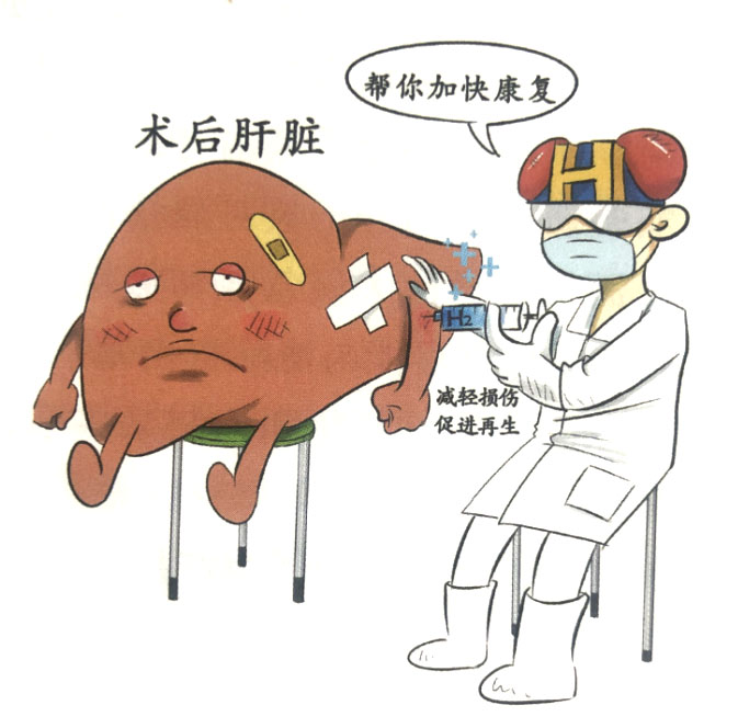 分子氫對肝切除術(shù)后肝功能的保護作用