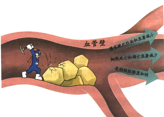 分子氫對心腦缺血性疾病的改善效應