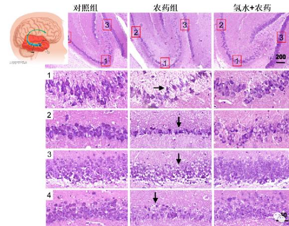 氫氣生物學(xué)機(jī)理：氫氣與乙酰膽堿酯酶