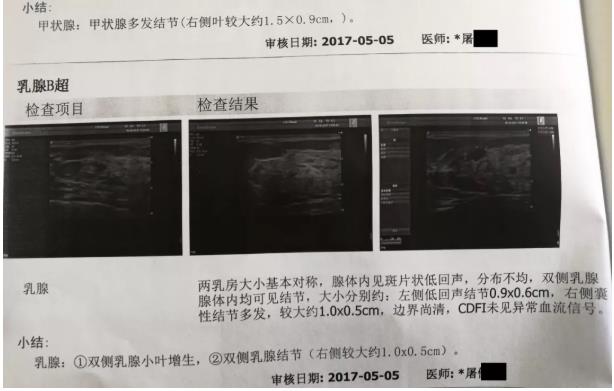 囊腫、息肉、結(jié)節(jié)，喝氫水都有效果