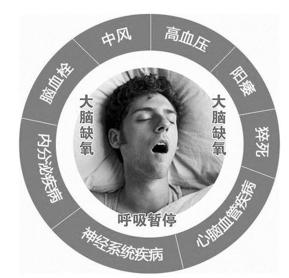 打呼嚕是病！可以用氫氣改善看看