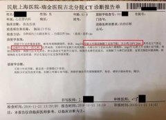 個案報道|肺磨玻璃樣結節(jié)